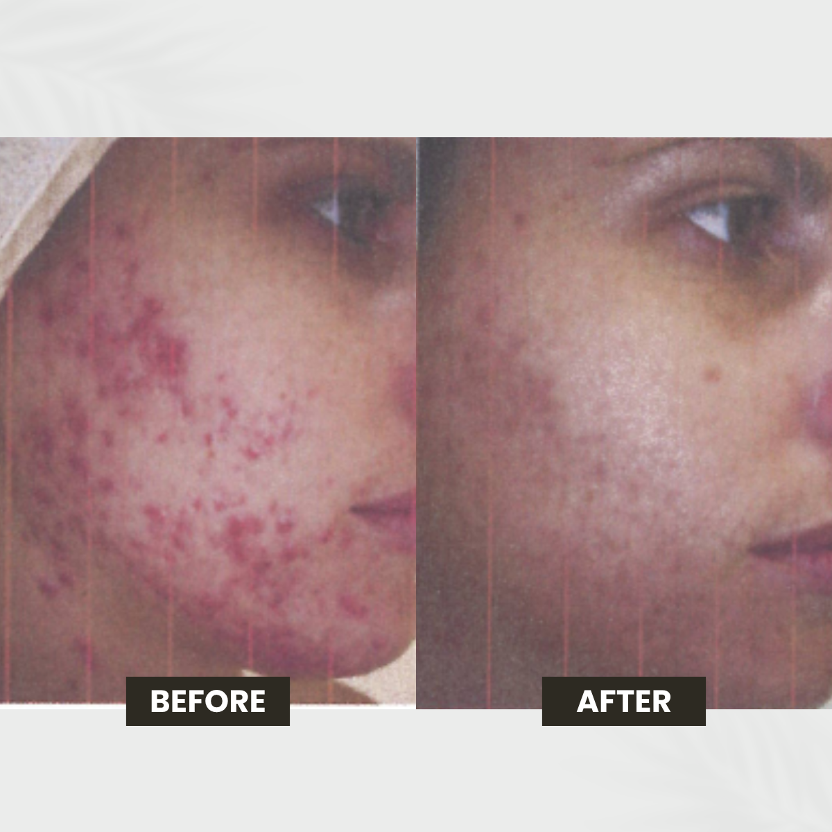 Sun Damage transformation result