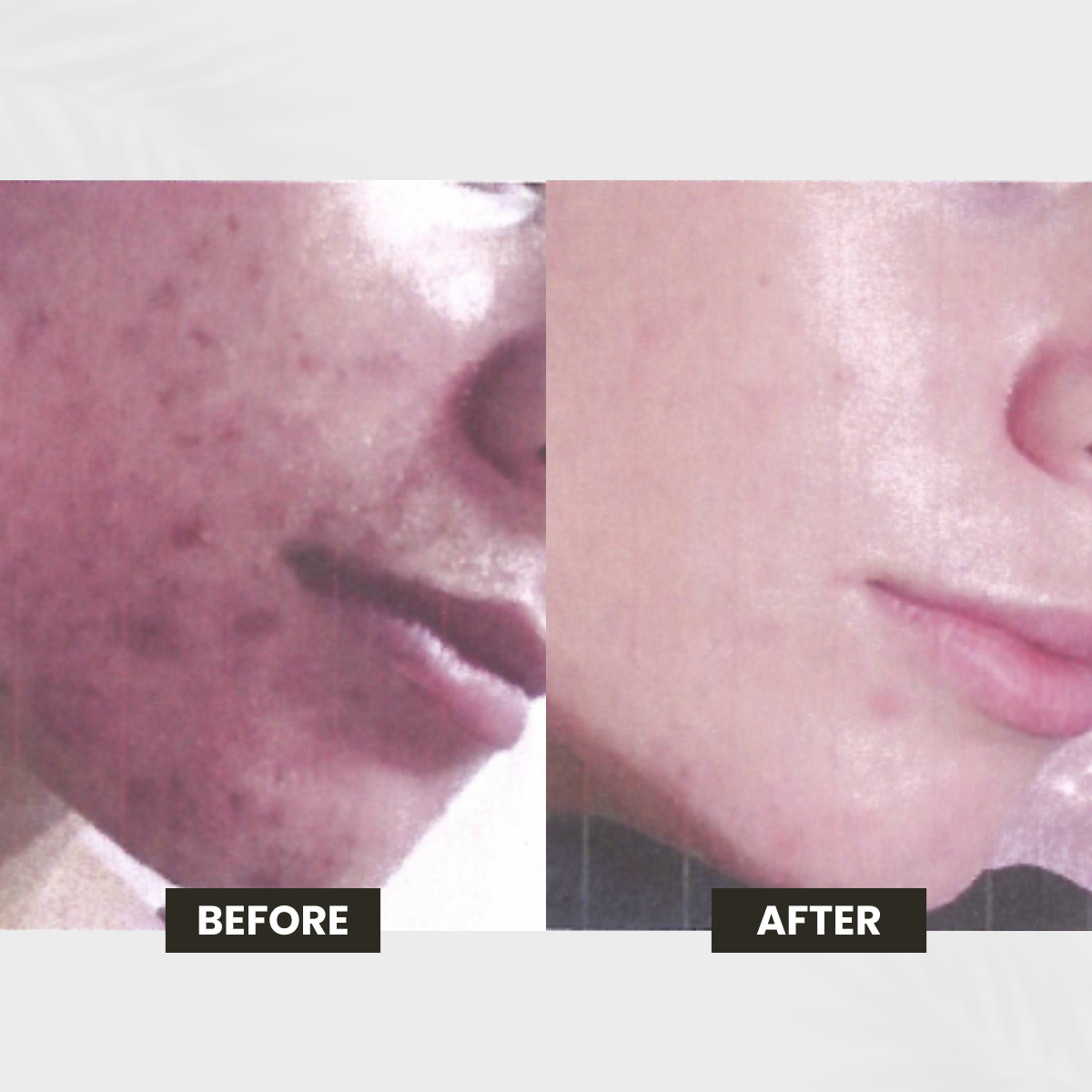 Uneven Skin Tone transformation result