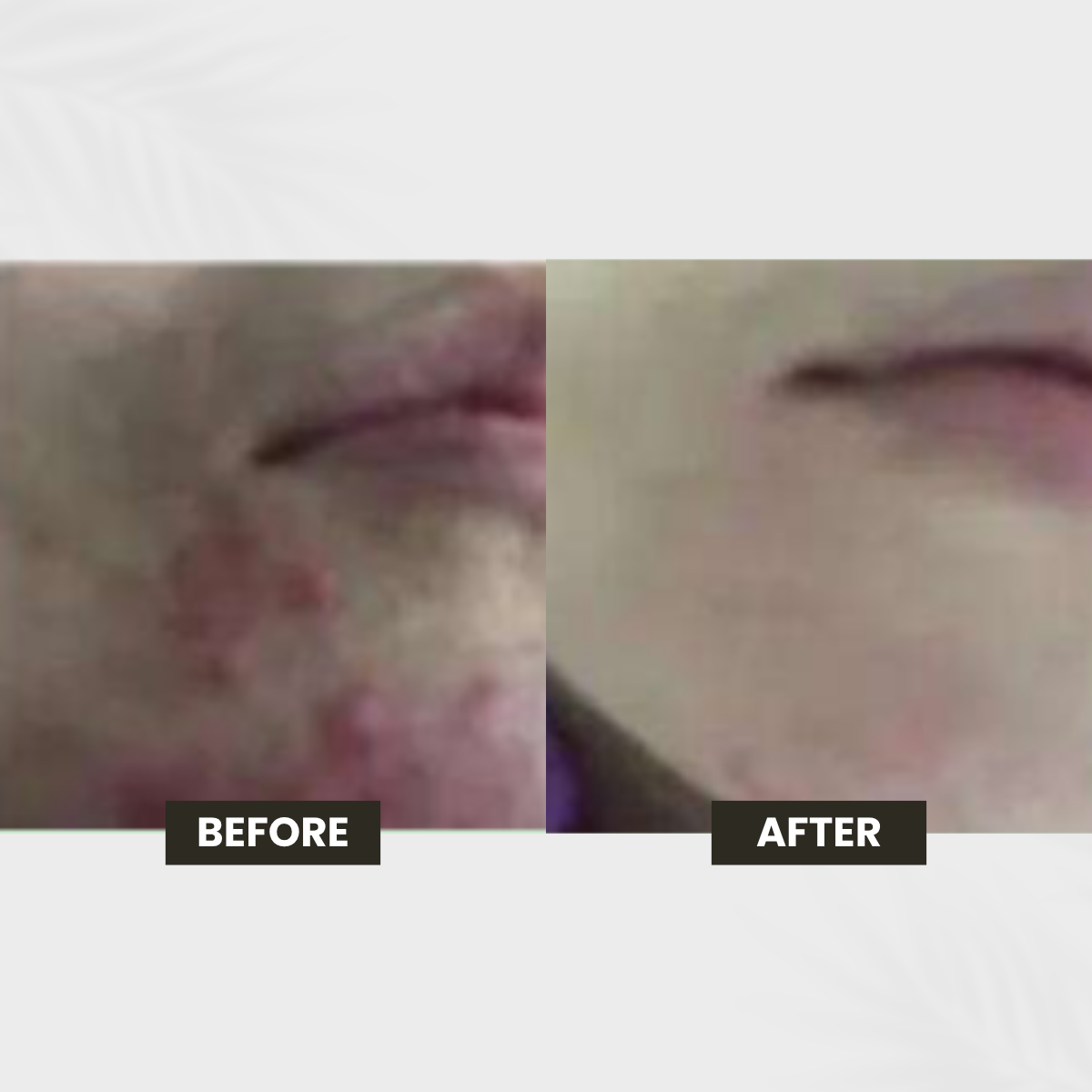 Textured Skin transformation result