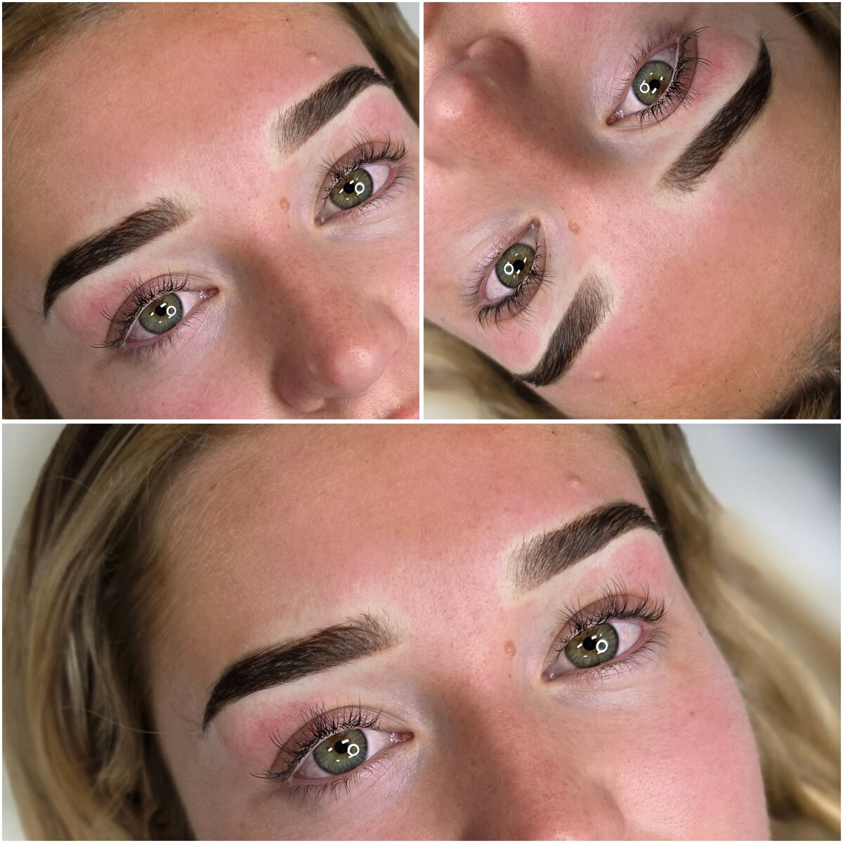 Beautiful Brow Results transformation result