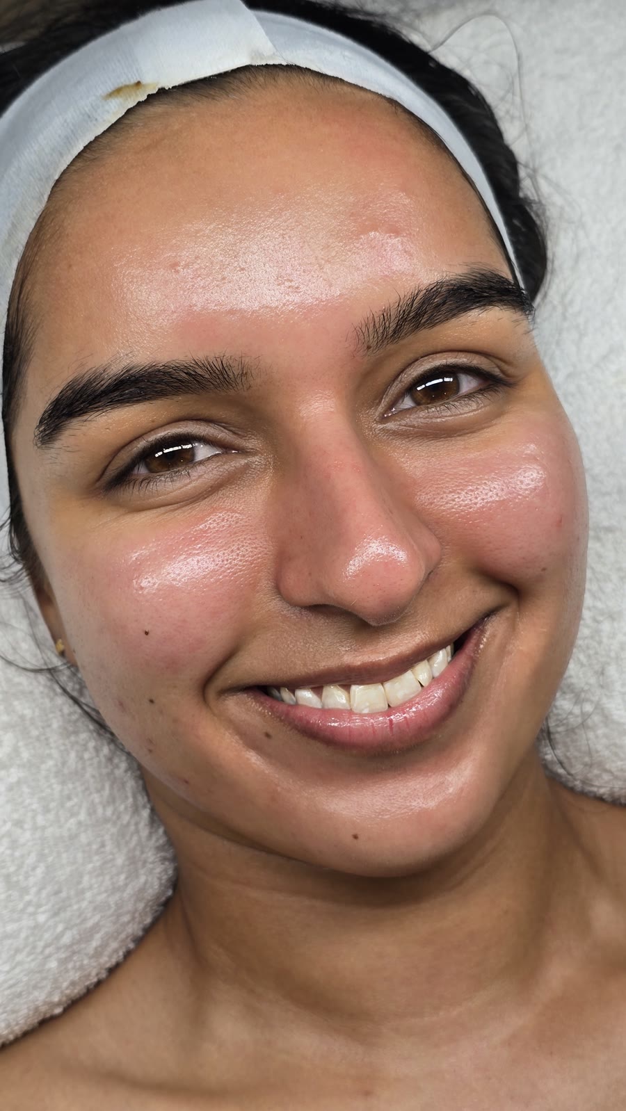 Hydrafacial