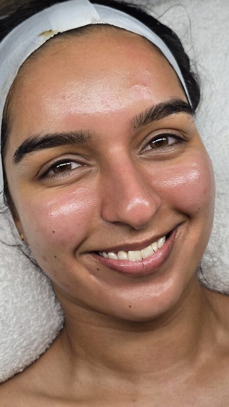 Radiant Glow transformation result