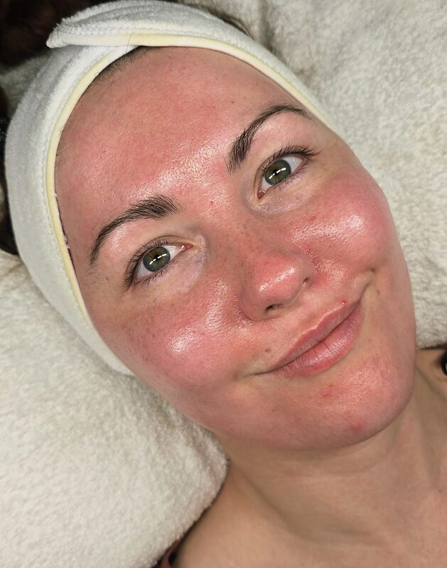 Deep Hydration transformation result