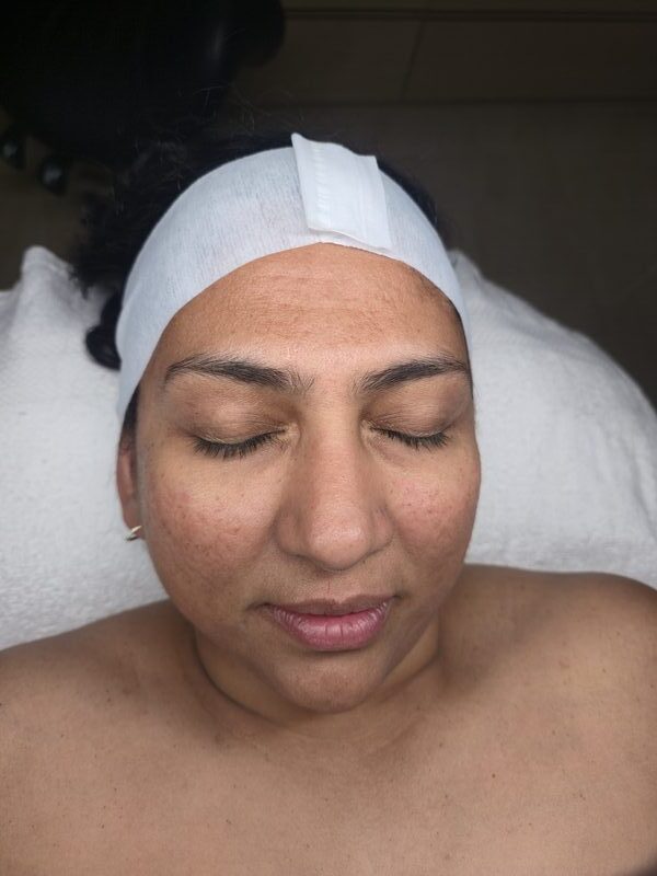 Skin Clarity transformation result