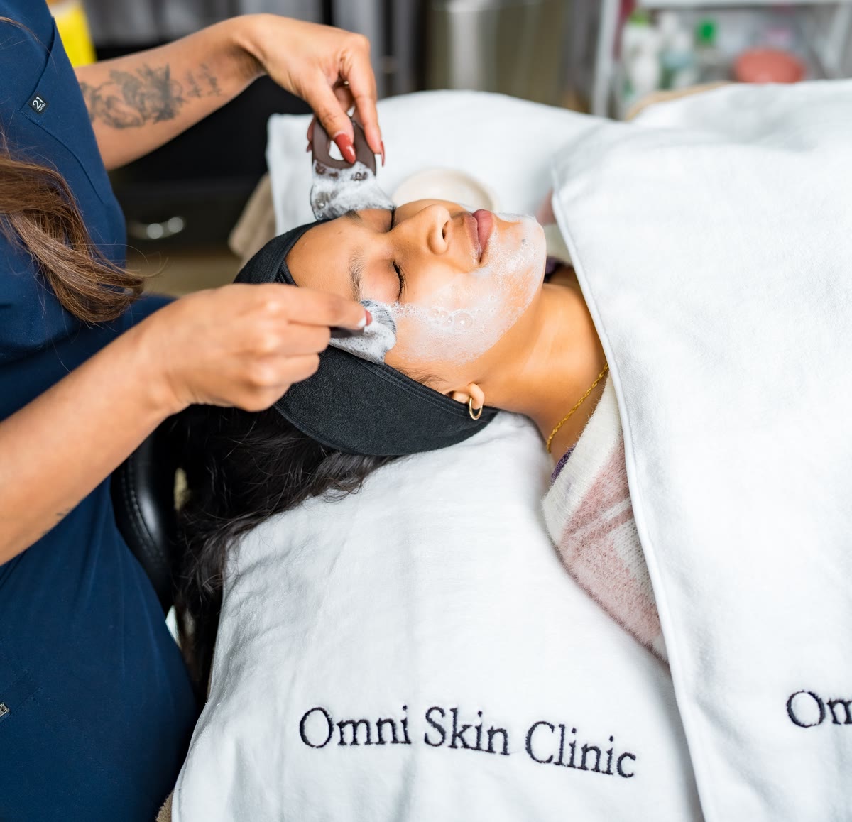 IPL Treatments