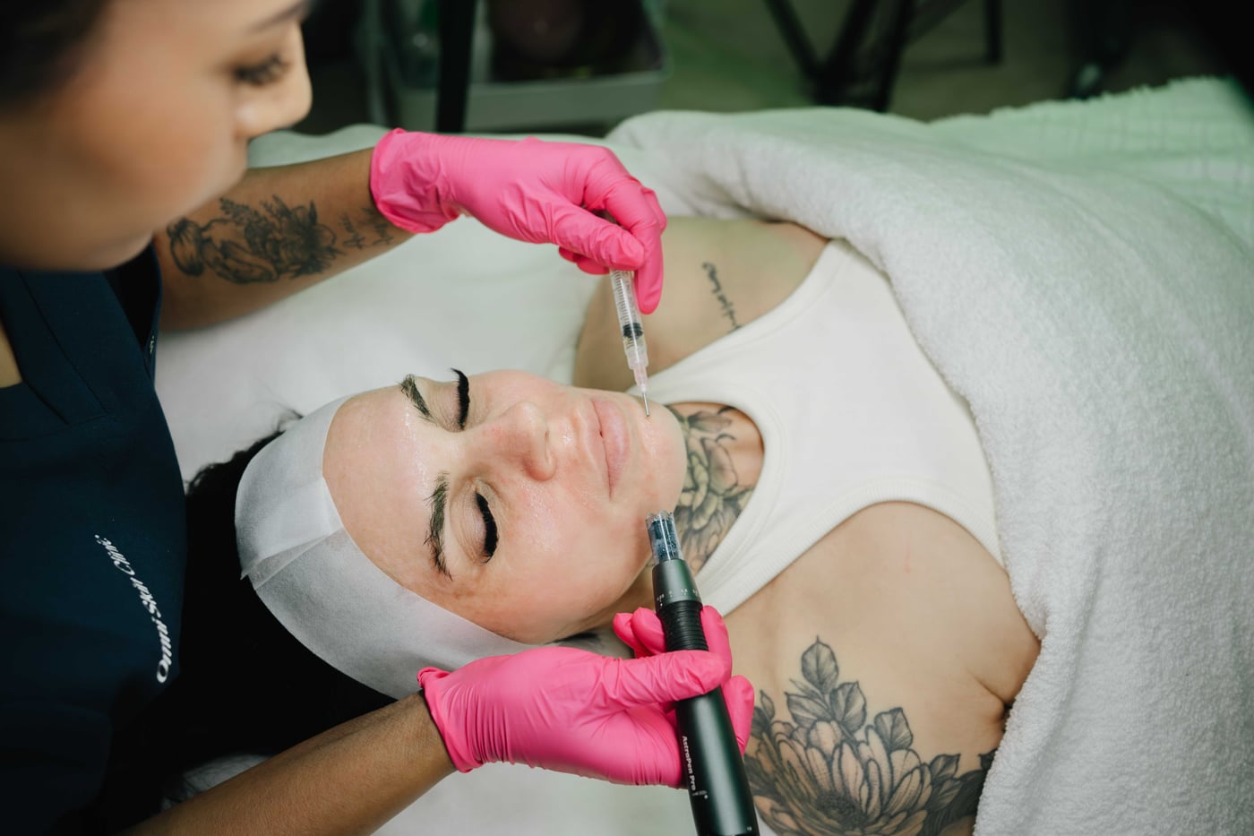 Microneedling treatment with the AstroPen Pro at Omni Skin Clinic, Brabham