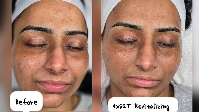 Client transformation result 2