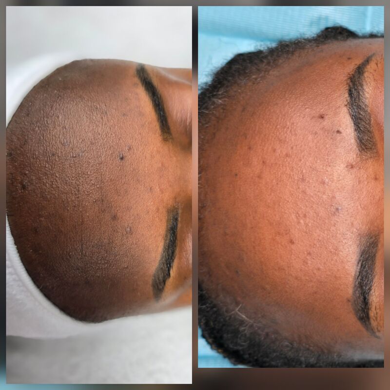 Client transformation result 4